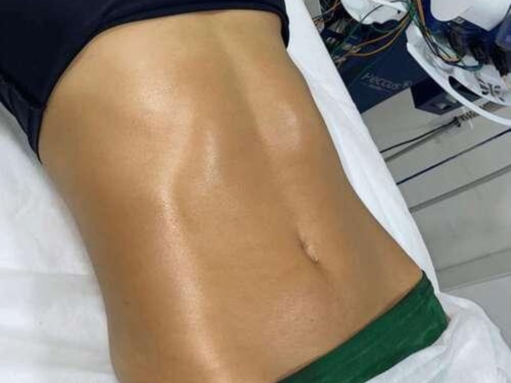 Drenagem Linfática - Image 4